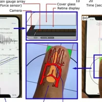 Đo Huyết Áp Bằng Iphone: Công Nghệ, Ứng Dụng Và Những Lưu Ý Quan Trọng